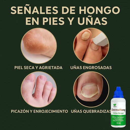 DERMAHONG X3 - Despídete de los hongos de forma natural🔥