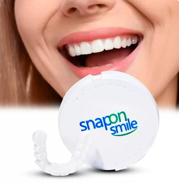 CARILLAS DENTALES AJUSTABLES - SNAP-ON SMILE😀