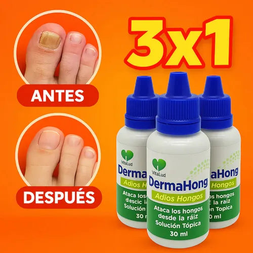 DERMAHONG X3 - Despídete de los hongos de forma natural🔥